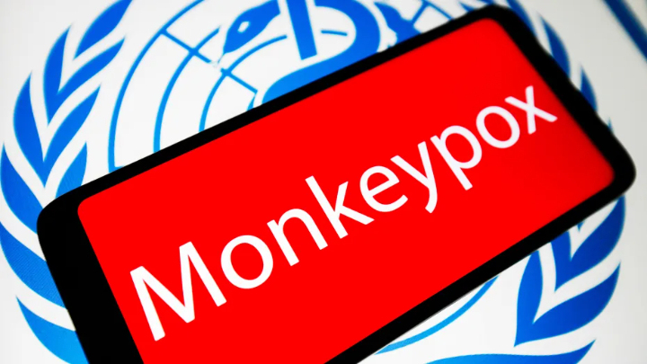 WHO says monkeypox not currently a global health emergency