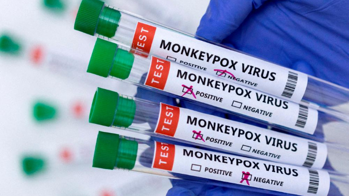 US expects monkeypox cases to continue climbing through August