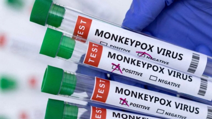 Monkeypox alarm: WHO urges South-East nations to strengthen health measures
