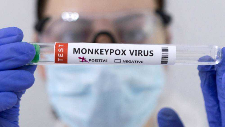 New York asks WHO to re-name 'stigmatizing' monkeypox