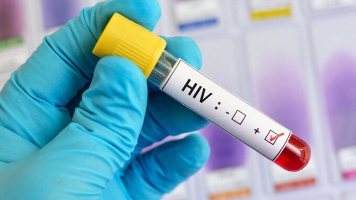 Global fight against HIV 'In Danger' amid resource crunch, says UN