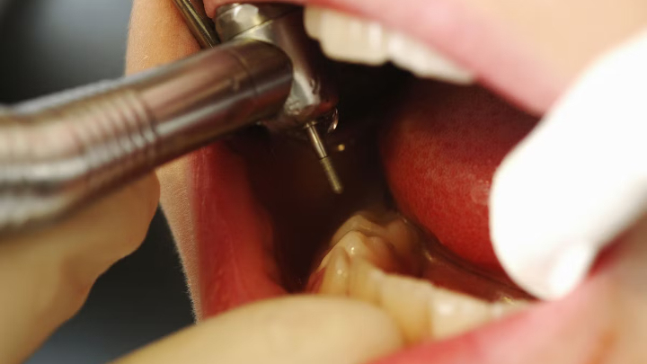 UK man travels to Bangladesh to receive dental treatment 
