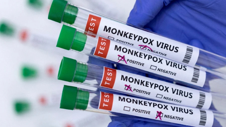 Cuba's first monkeypox case recorded in Italian tourist